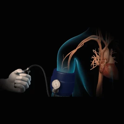Hypertension Hypertension
