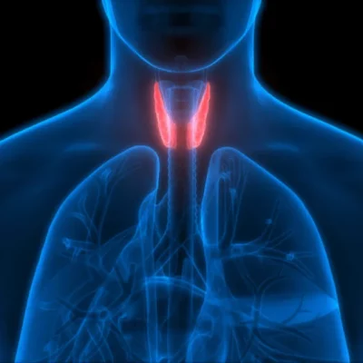 Hypothyroidism Hypothyroidism