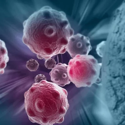 Oncology Oncology