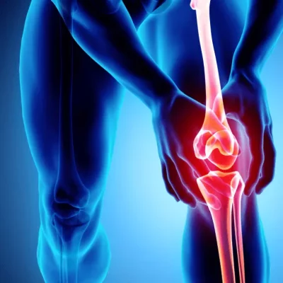 Osteoarthritis Osteoarthritis
