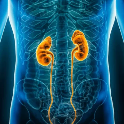 Renal care Renal care