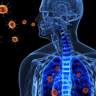 Viral infections Viral infections