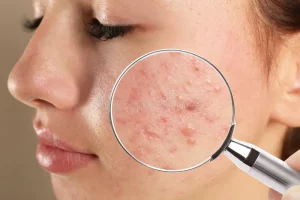 dermatoloy